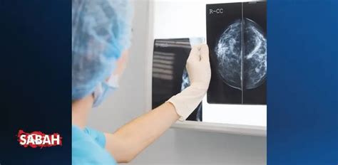 mamografi çekimi ne kadar sürer